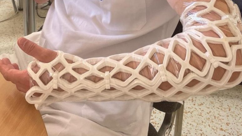 Speciální fixace OPENCAST.