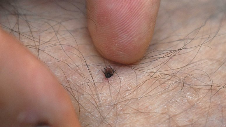 Infekční ambulance očkování encefalitida