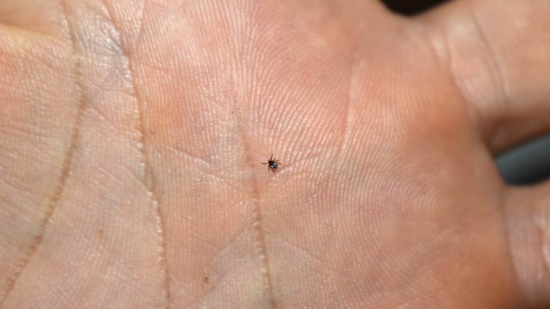 Očkování encefalitida